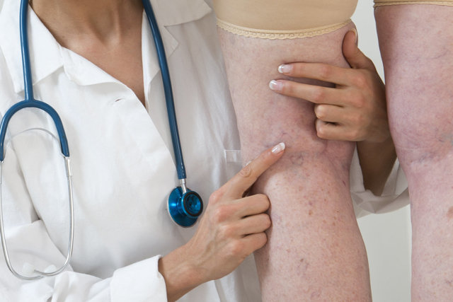 Тяжесть в ногах ниже колена у женщин - причины и профилактика