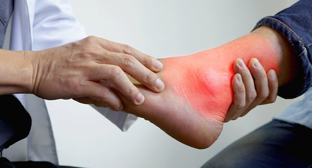 Лечение подагры народными средствами, как лечить подагрический артрит на пальцах ног